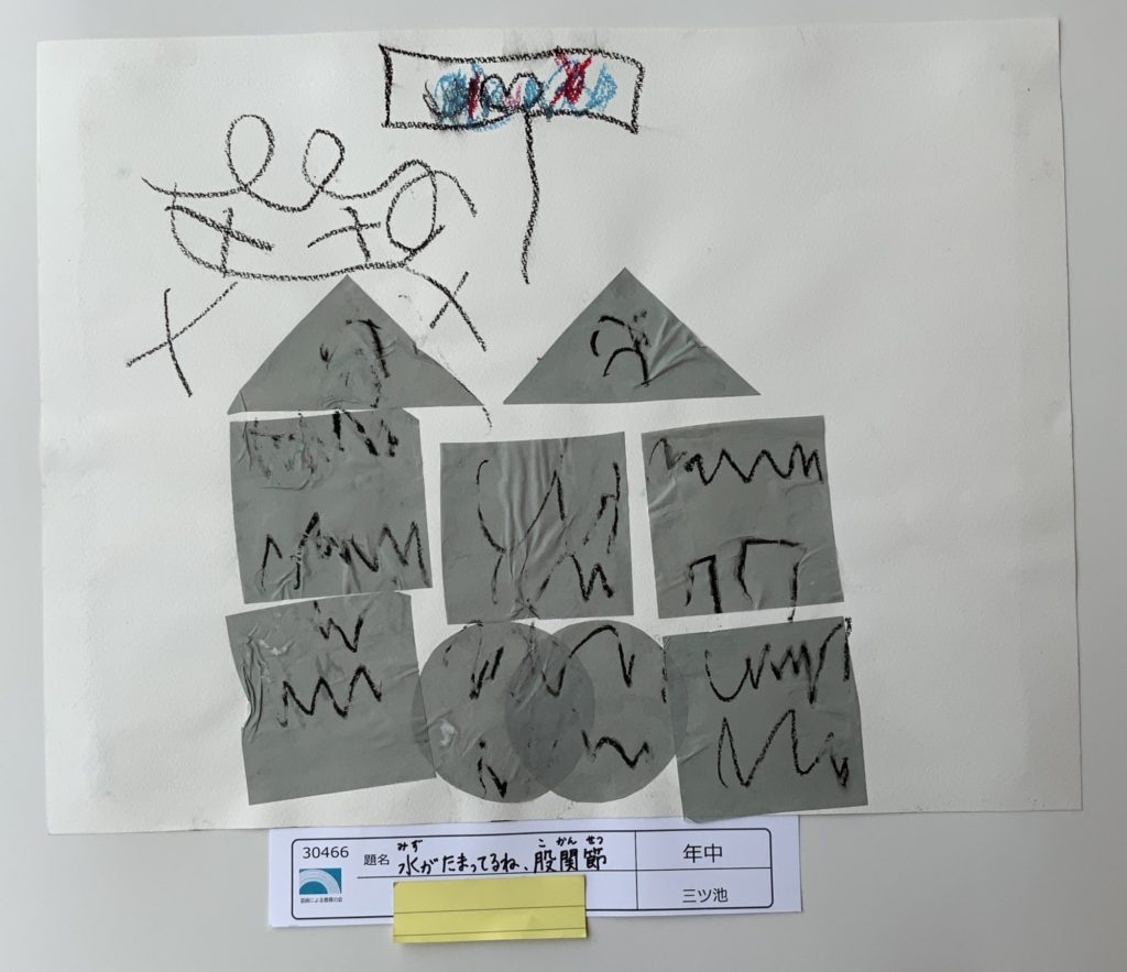 みずがたまってるね、股関節